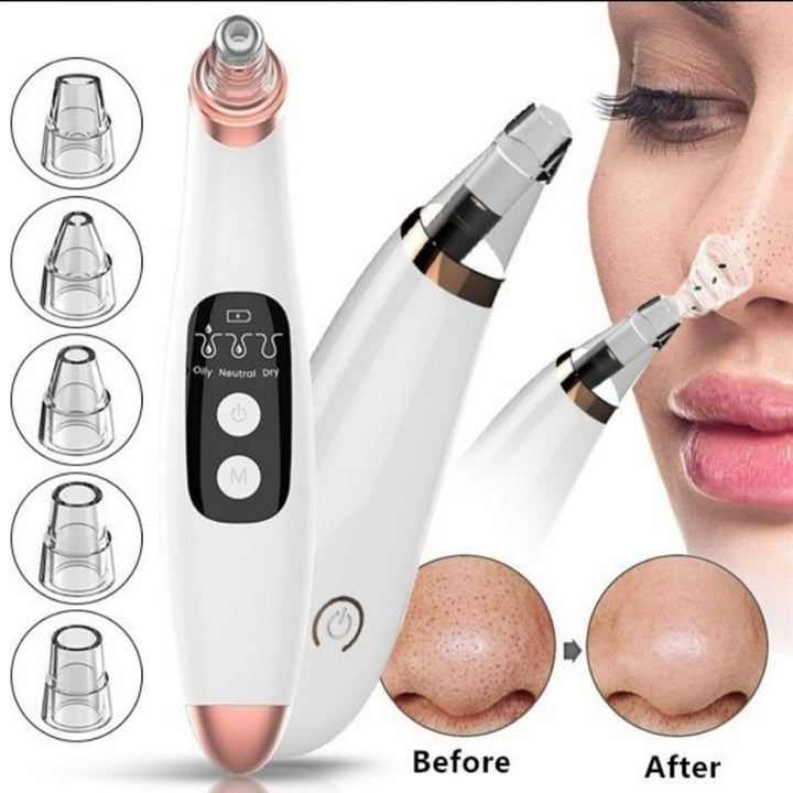 Mihraaj | Multifunction Blackhead Remover – 5-in-1 Deep Pore Cleansing Mihraaj