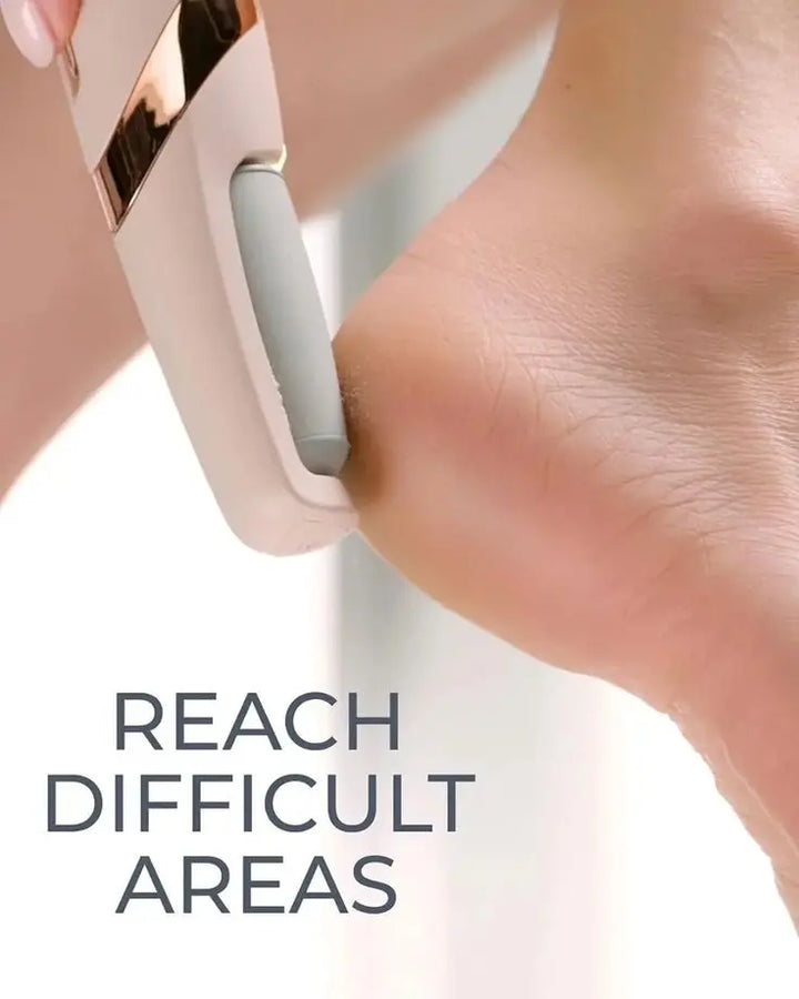 Mihraaj | Electric Foot Callus Remover – Pedicure File for Cracked Heels Mihraaj
