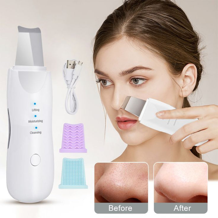 Mihraaj | Blackhead Removal Device – Rechargeable Skin Scrubber & Facial Cleaner Mihraaj