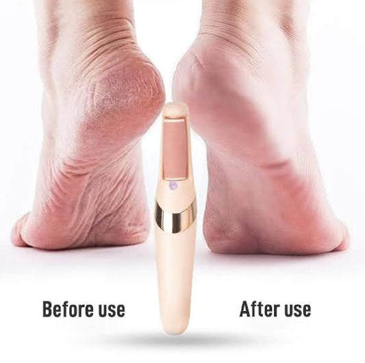 Mihraaj | Electric Foot Callus Remover – Rechargeable Pedicure File for Dead Skin, Cracked Heels & Smooth Feet