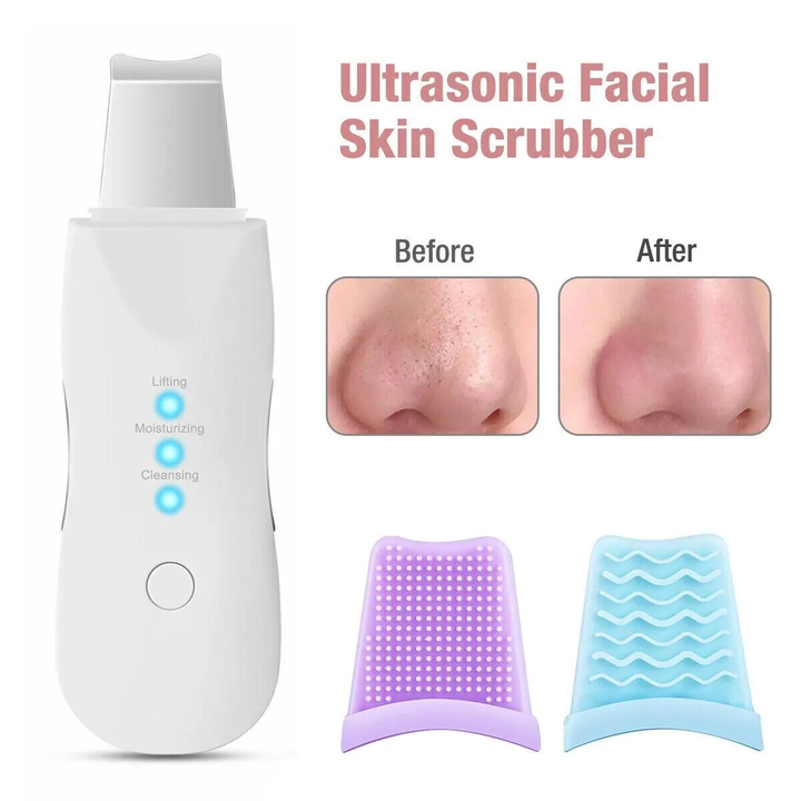 Mihraaj | Blackhead Removal Device – Rechargeable Skin Scrubber & Facial Cleaner Mihraaj